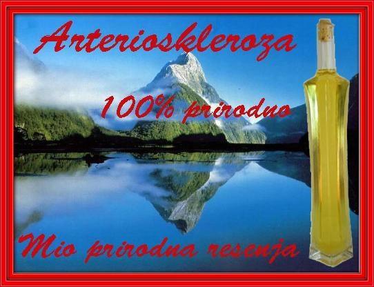 Arterioskleroza