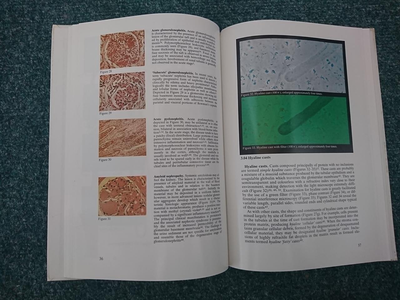 Urine-Under-the-Microscope---Roche-Laboratories