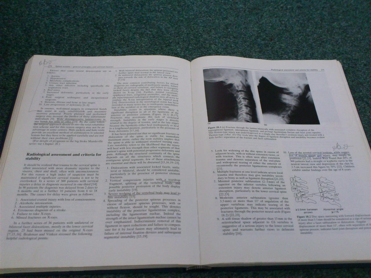 Spinal-Surgery--Science-and-Practice---Dickson