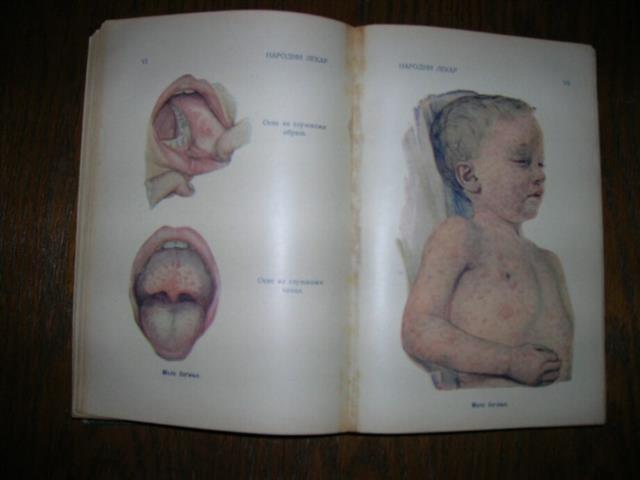 NARODNI-LEKAR---Dr-Dobr--Ger--Popovic