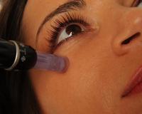 Dermapen