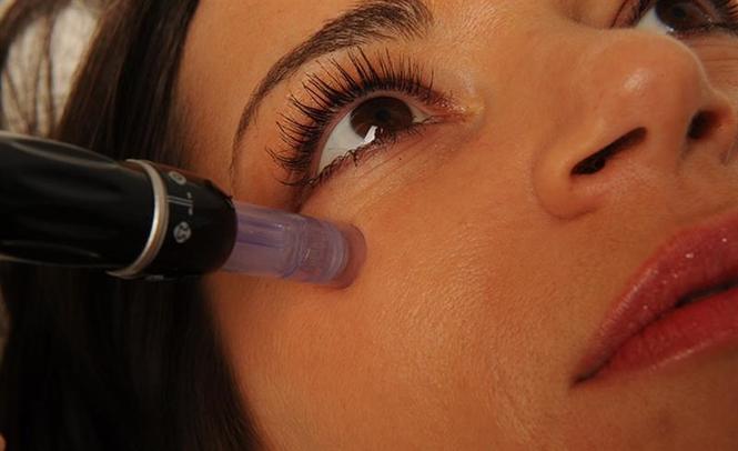 Dermapen