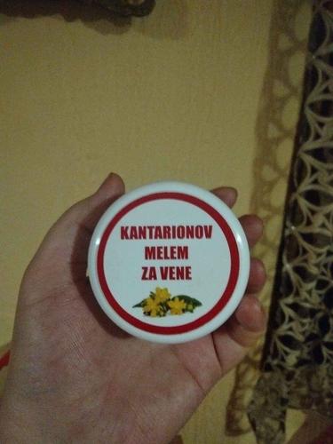 Kako da resite problem prosirenih vena?