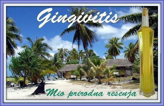 Gingivitis