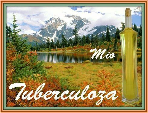 Tuberkuloza