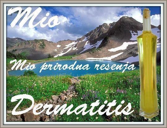 Dermatitis