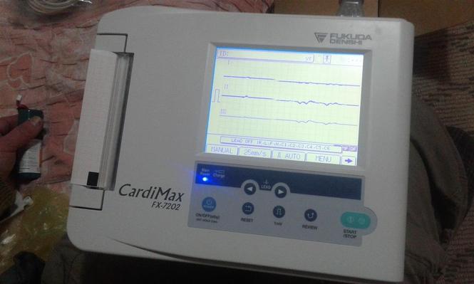 EKG Aparat