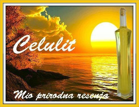 Celulit