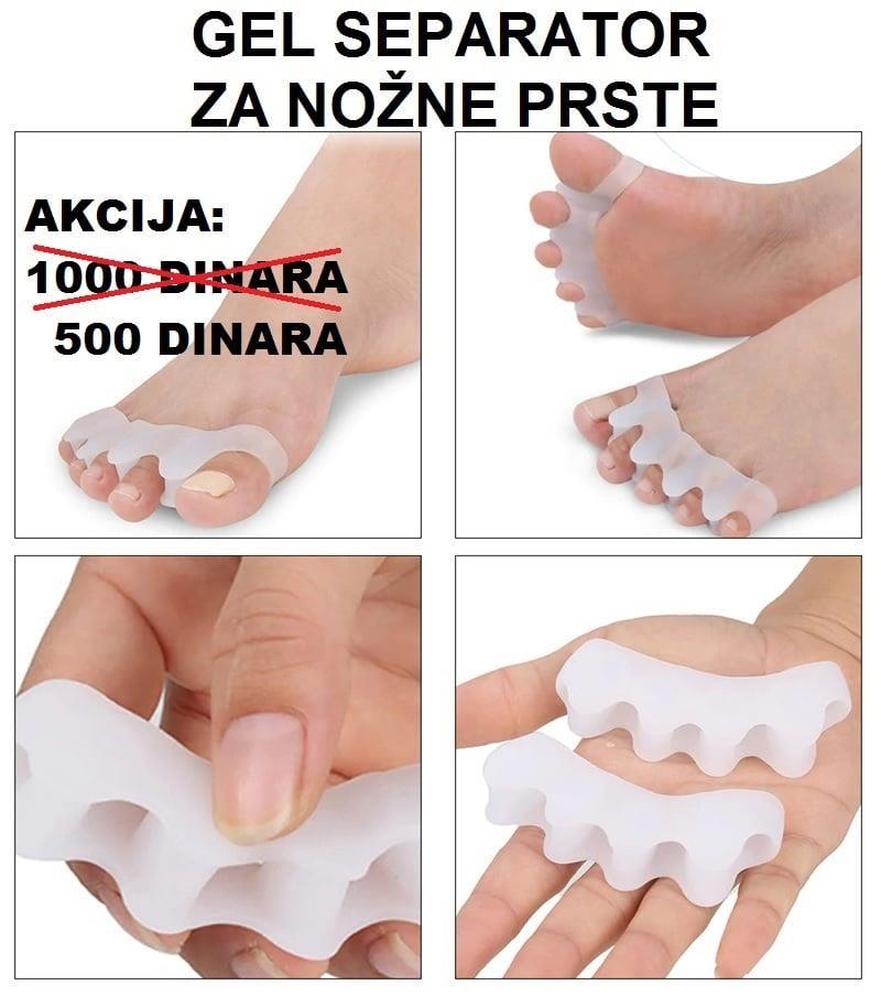 SEPARATORI-I-LONGETE---AKCIJA---