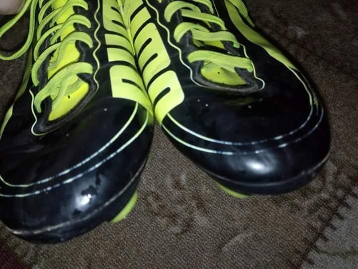 Kopacke