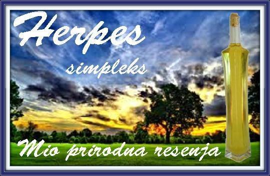 Herpes simpleks